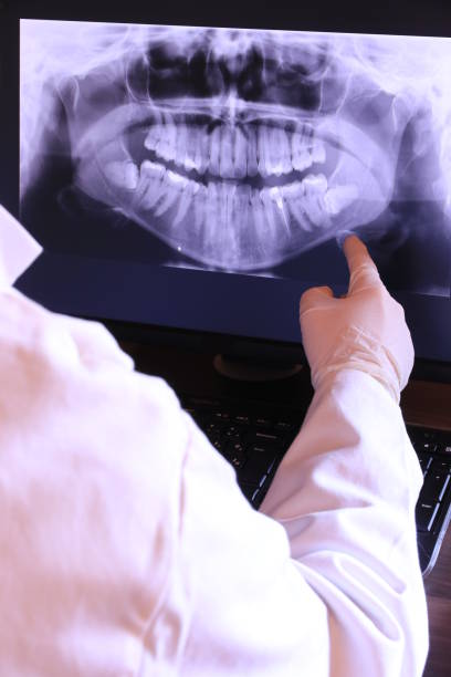 Best Broken or Cracked Tooth Emergency Dentist in Berryville, VA