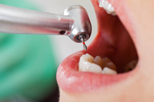Best Orthodontic Emergency Dentist in Berryville, VA
